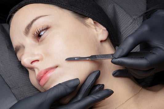 Trattamento Dermaplaning (metodo Marie)